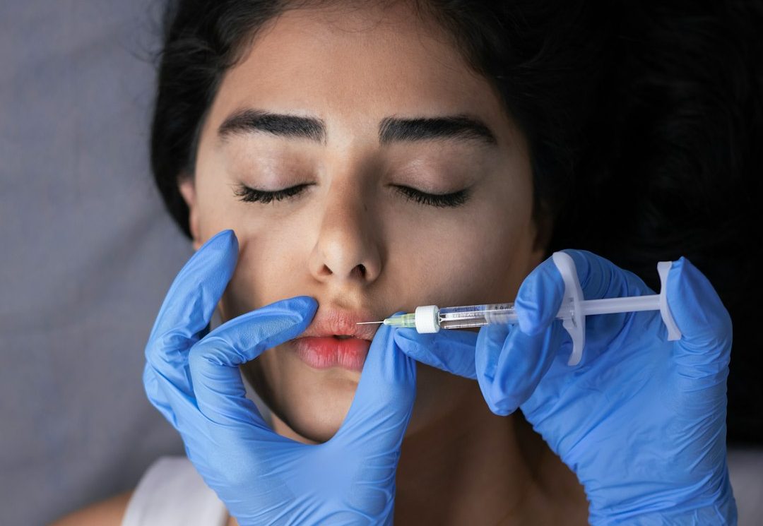 Lip filler injection treatment
